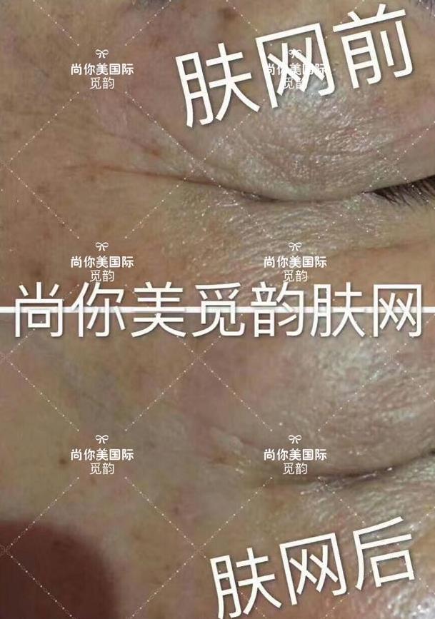 美白面膜哪个牌子的效果好价格便宜点